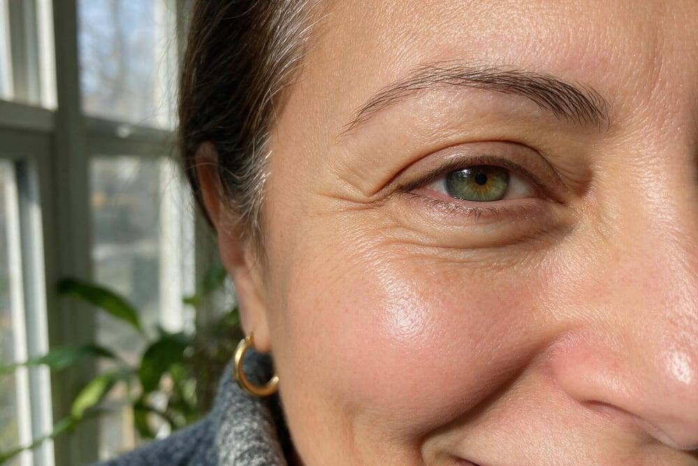 Close-up of skin around the eyes at four weeks