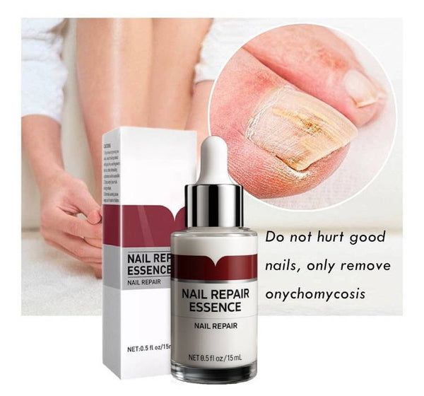Nail Fungus Buster
