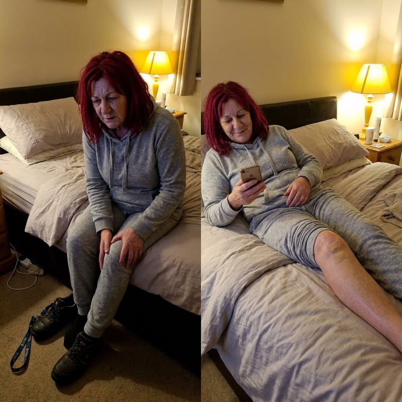 Melissa B. before and after — knee pain eased